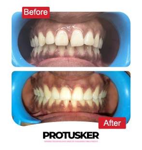 before after images 01 (1)