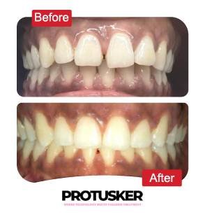 before after images 02