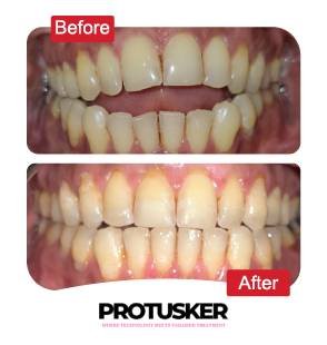 before after images 07