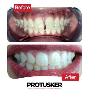 before after images 09