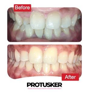 before after images 10