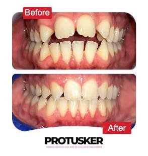 before after images 11