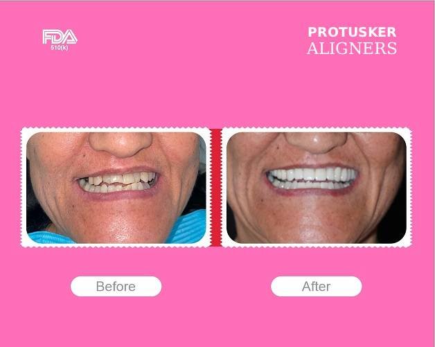 jaineelparekh(elizabeth) (1)